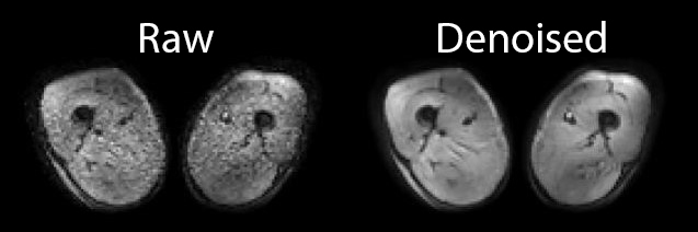 dti data denoising using MP-PCA